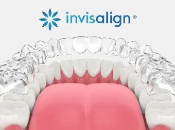 Caring for Your Invisalign Aligners: Tips for Best Results