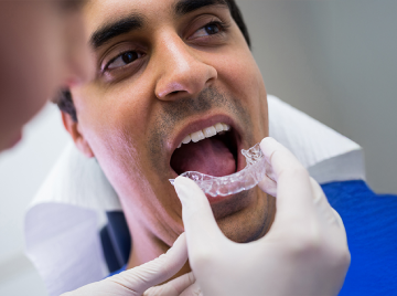 Palatal Expander Benefits: Why Dentists Recommend Them