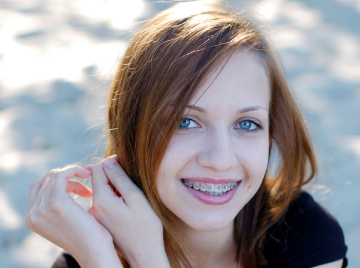 Early Orthodontic Evaluations in San Antonio for Kids’ Smiles